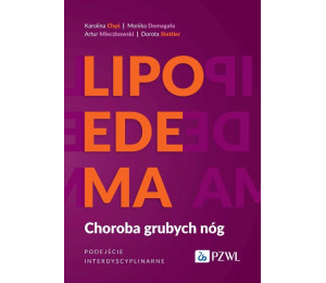 Lipoedema. Choroba grubych nóg