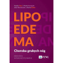 Lipoedema. Choroba grubych nóg