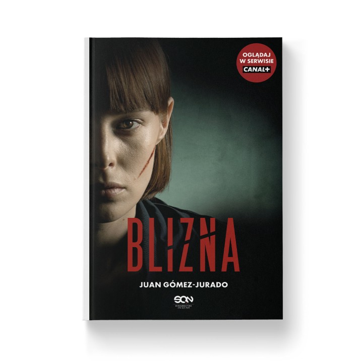 Blizna