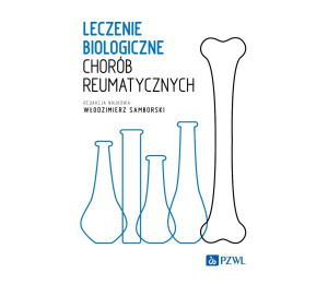 Leczenie biologiczne chorób reumatycznych