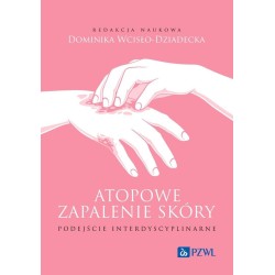 Atopowe zapalenie skóry. Podejście interdyscyplina