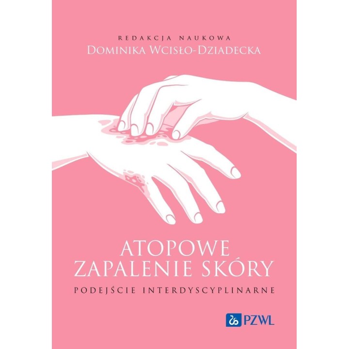 Atopowe zapalenie skóry. Podejście interdyscyplina