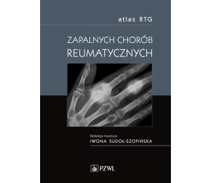 Atlas RTG zapalnych chorób reumatycznych