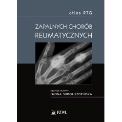 Atlas RTG zapalnych chorób reumatycznych