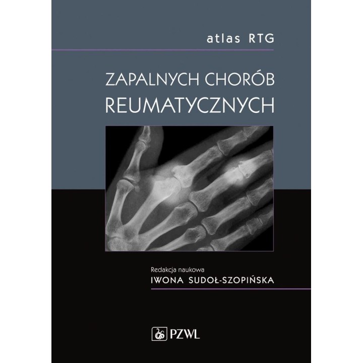 Atlas RTG zapalnych chorób reumatycznych