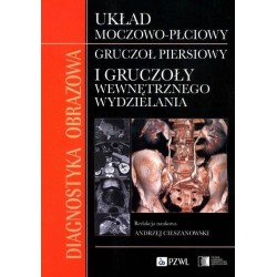 Diagnostyka obrazowa Układ moczowo-płciowy Gruczoł