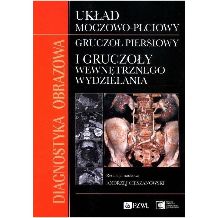 Diagnostyka obrazowa Układ moczowo-płciowy Gruczoł