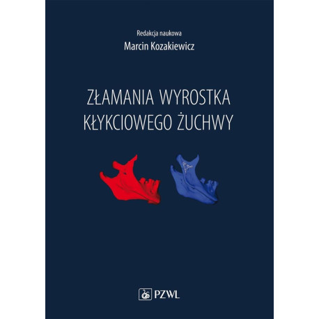 Złamania wyrostka kłykciowego żuchwy