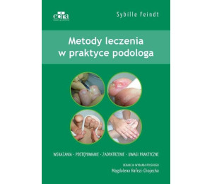 Metody leczenia w podologii