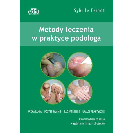 Metody leczenia w podologii