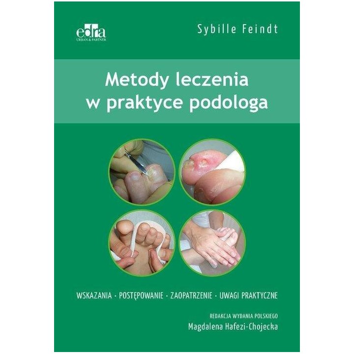 Metody leczenia w podologii