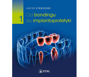 Od bondingu do implantoprotetyki cz. I