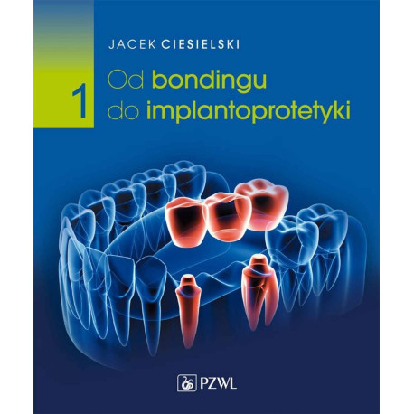 Od bondingu do implantoprotetyki cz. I