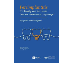 Periimplantitis. Profilaktyka i leczenie tkanek...
