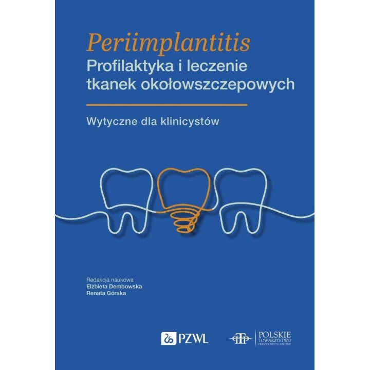 Periimplantitis. Profilaktyka i leczenie tkanek...