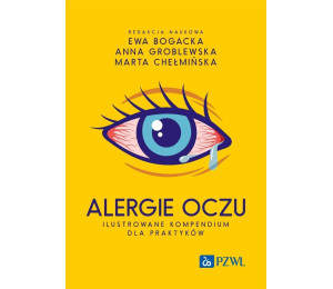 Alergie oczu. Ilustrowane kompendium dla praktyków