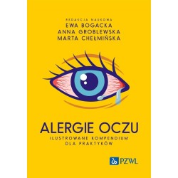 Alergie oczu. Ilustrowane kompendium dla praktyków