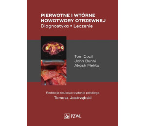 Pierwotne i wtórne nowotwory otrzewnej. Diagnostyk