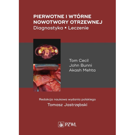 Pierwotne i wtórne nowotwory otrzewnej. Diagnostyk