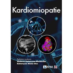 Kardiomiopatie