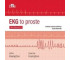 EKG to proste