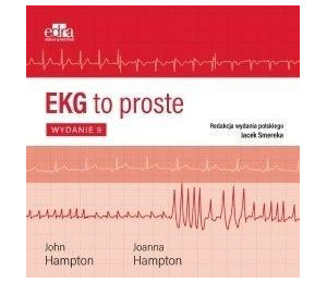 EKG to proste