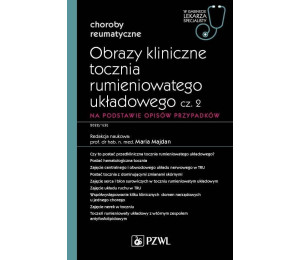 Obrazy kliniczne tocznia rumieniowatego układ cz.2