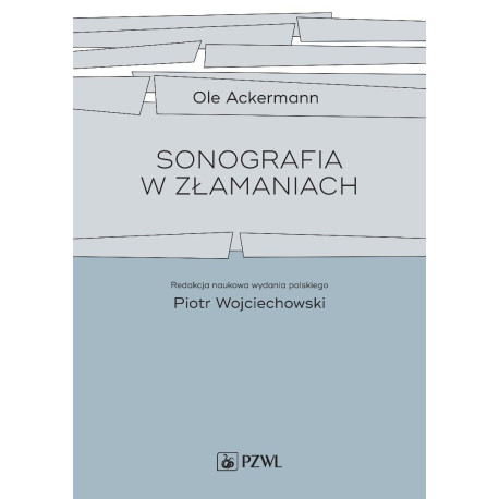 Sonografia w złamaniach