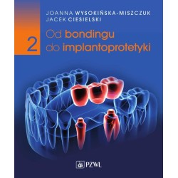 Od bondingu do implantoprotetyki cz.2