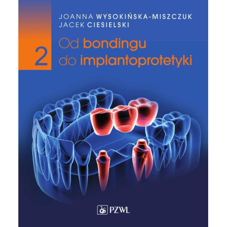 Od bondingu do implantoprotetyki cz.2