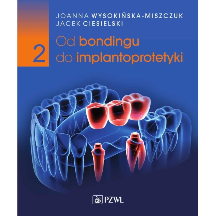 Od bondingu do implantoprotetyki cz.2