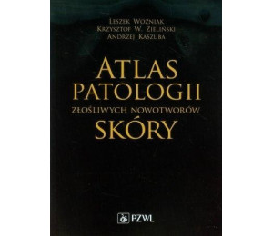 Atlas patologii złośliwych nowotworów skóry