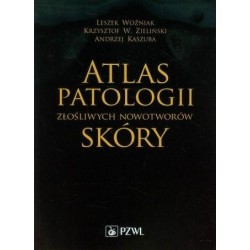 Atlas patologii złośliwych nowotworów skóry