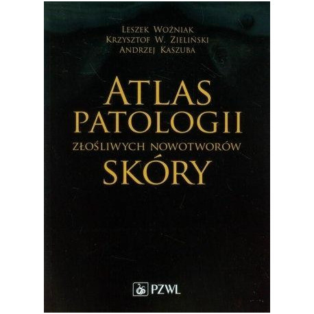 Atlas patologii złośliwych nowotworów skóry