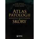 Atlas patologii złośliwych nowotworów skóry