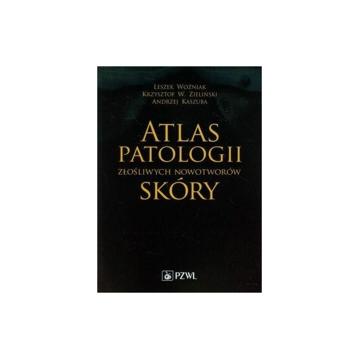 Atlas patologii złośliwych nowotworów skóry