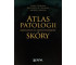 Atlas patologii złośliwych nowotworów skóry