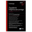 Zapalenie mięśnia sercowego. W gabinecie