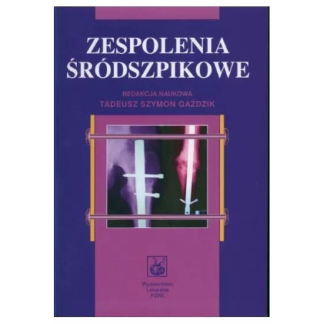 Zespolenia śródszpikowe