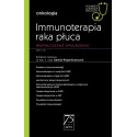 Immunoterapia raka płuca. W gabinecie lekarza...