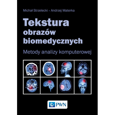 Tekstura obrazów biomedycznych. Metody analizym...