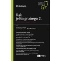 Rak jelita grubego 2. Wybrane zagadnienia