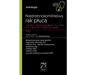 Niedrobnokomórkowy rak płuca. W gabinecie lekarza