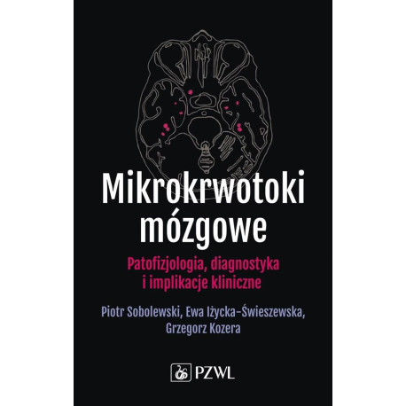 Mikrokrwotoki mózgowe