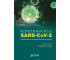 Koronawirus SARS-CoV-2 - zagrożenie..