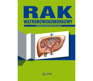 Rak wątrobowokomórkowy