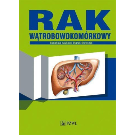 Rak wątrobowokomórkowy