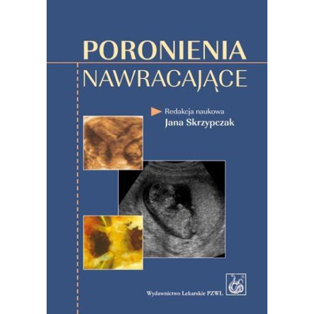 Poronienia nawracające