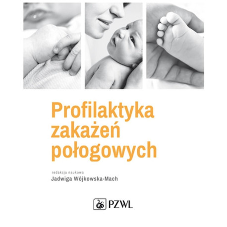 Profilaktyka zakaźeń połogowych