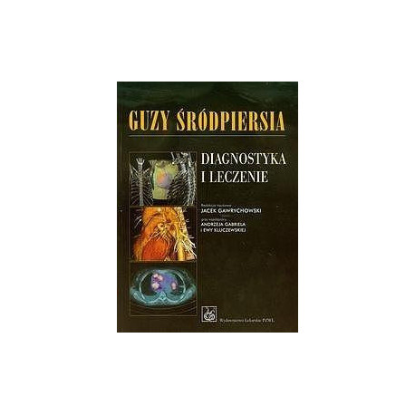Guzy śródpiersia Diagnostyka i leczenie